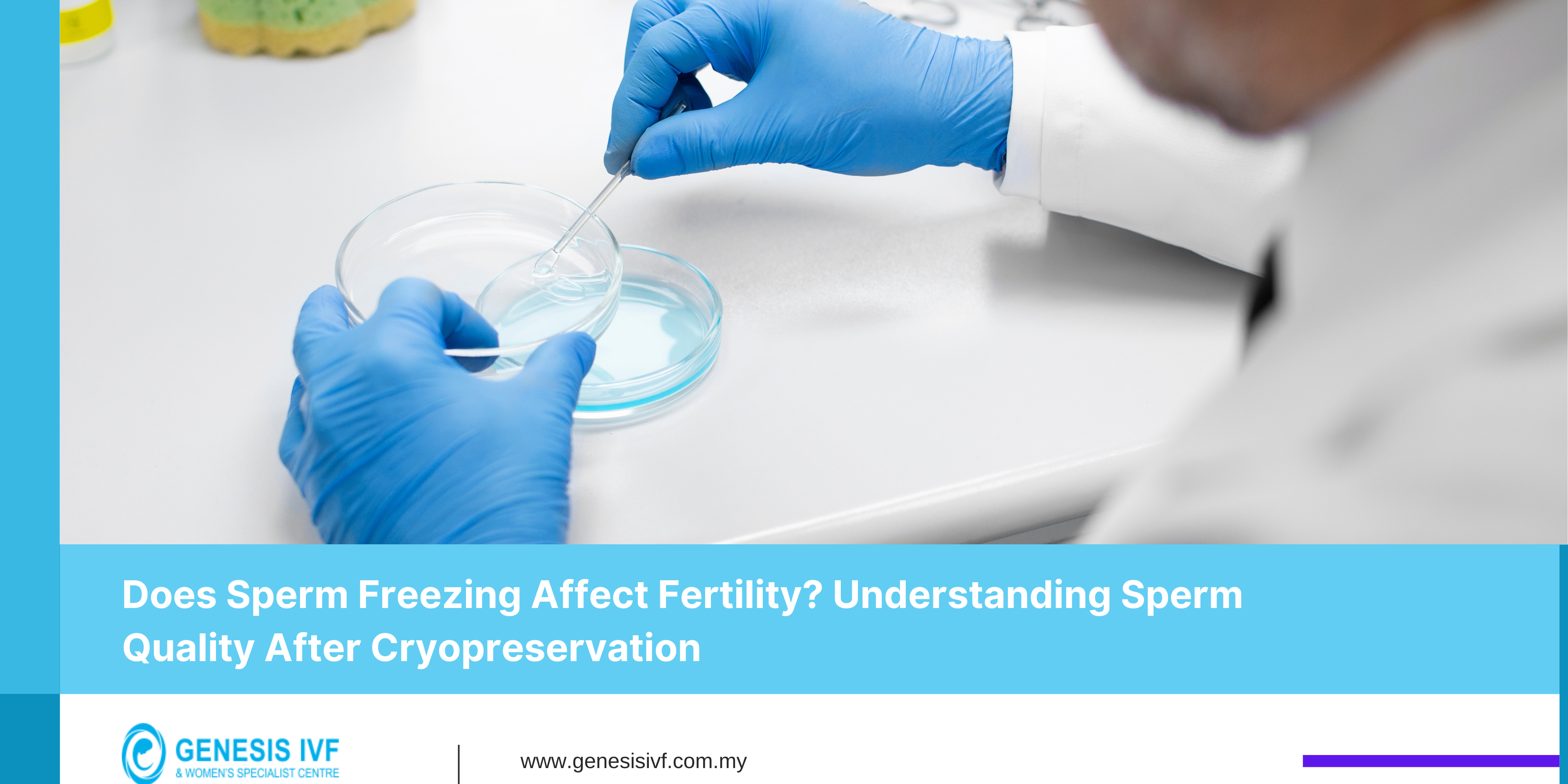 Does Sperm Freezing Affect Fertility Understanding Sperm Quality After Cryopreservation-IVF